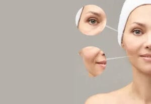 reduction of fine lines and  wrinkles