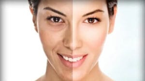 glutathione and whiten skin